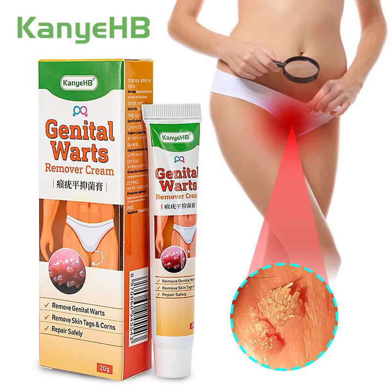 Genital Warts and Skin Tag Treatment Cream