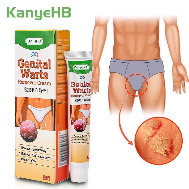 Genital Warts and Skin Tag Treatment Cream