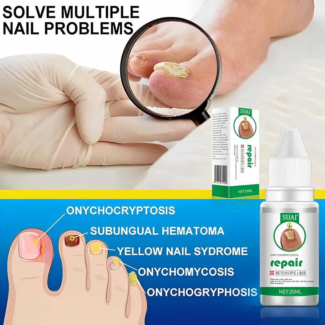 Nail Fungal Ointment.