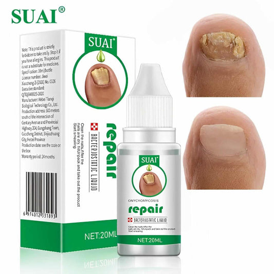 Nail Fungal Ointment.
