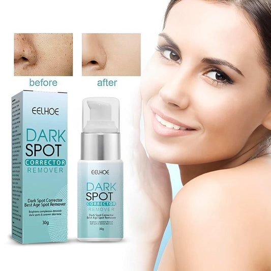 Dark Spot Remover.