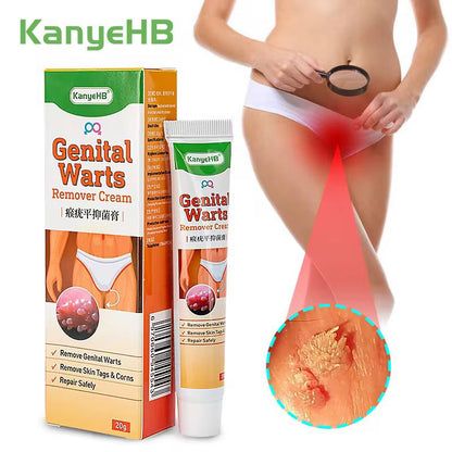 Genital Warts and Skin Tag Treatment Cream